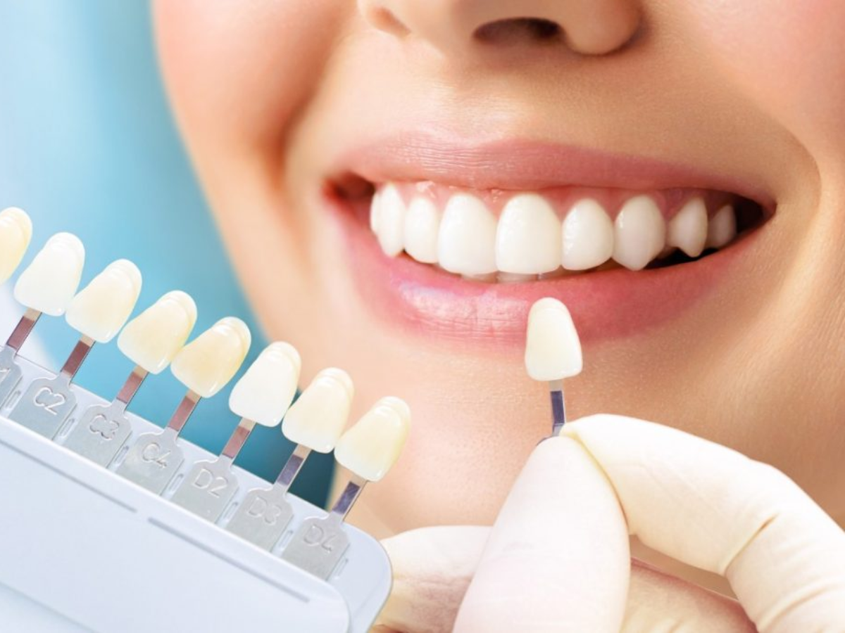 Como a estética dental pode transformar seu sorriso e sua autoestima